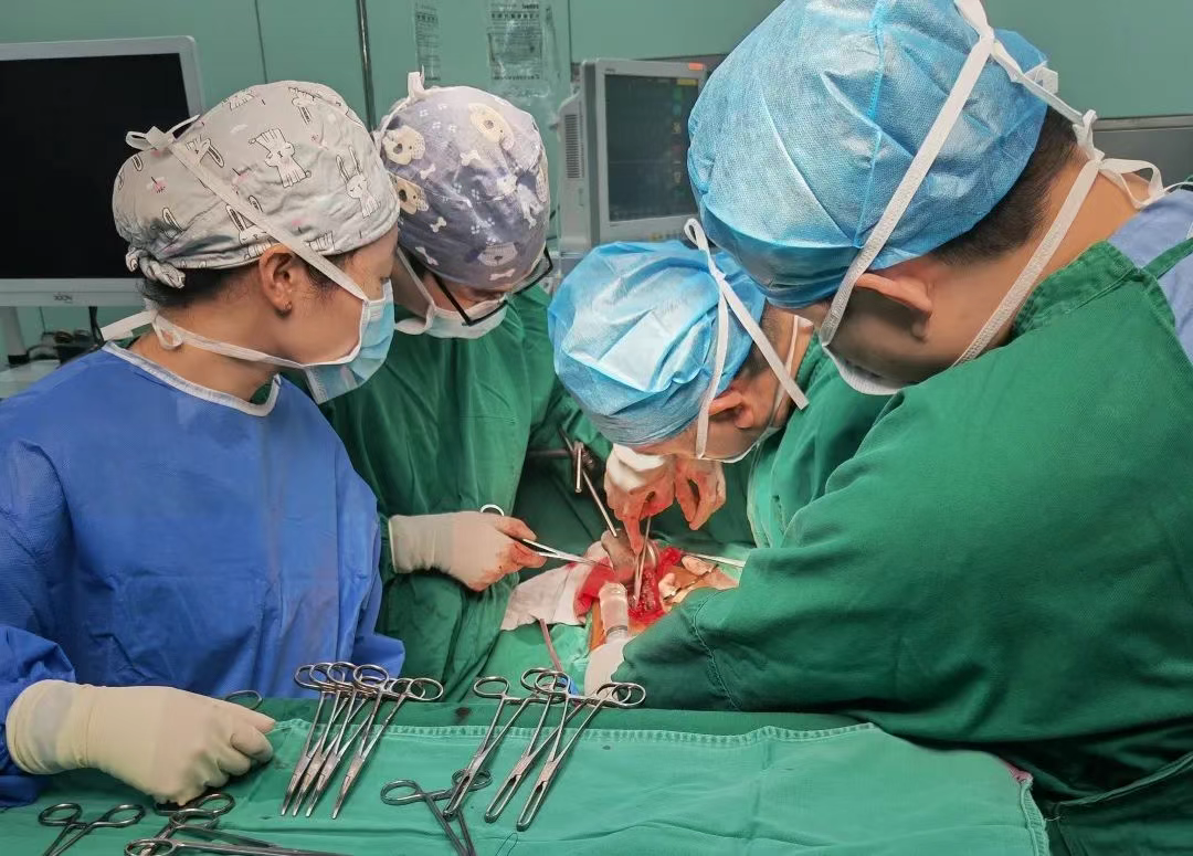 肝破裂危在旦夕，多学科抢救转危为安